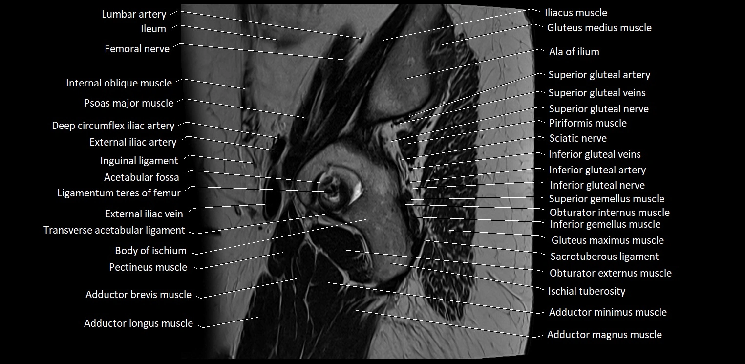 Sagittal cross sectional anatomy of female pelvis (MRI 3T) image 2.webp